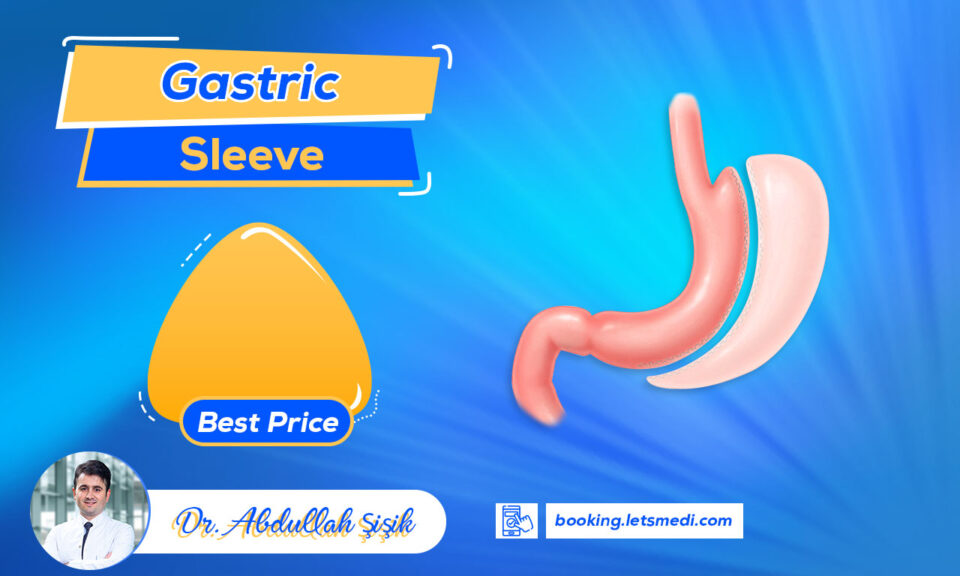 Gastric Sleeve Letsmedi